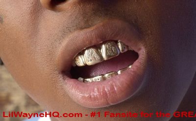 Chris brown with and without teeth grillz. 